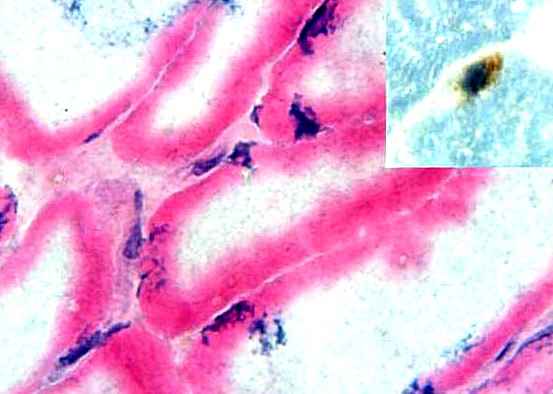 Живые стволовые клетки обнаружены в человеческом теле спустя 17дней после смерти