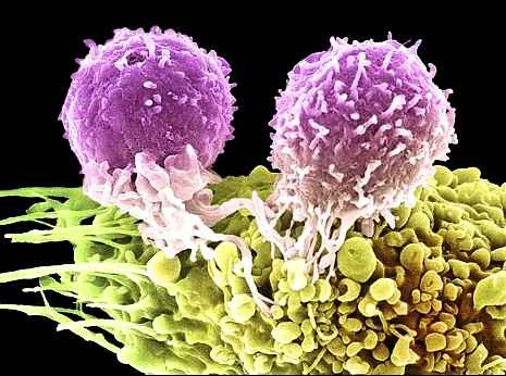 Бессмертны ли раковые клетки