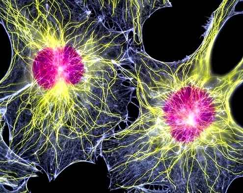 Ученые обнаружили раковые стволовые клетки