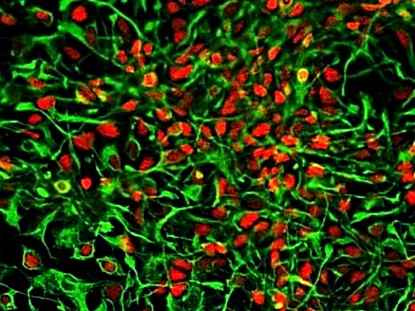 Биологи получили стволовые клетки мозга из клеток почечного эпителия