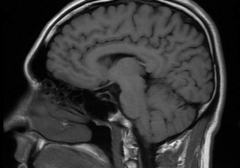 Каталог сканирования мозга поможет нам понять процесс нормального старения